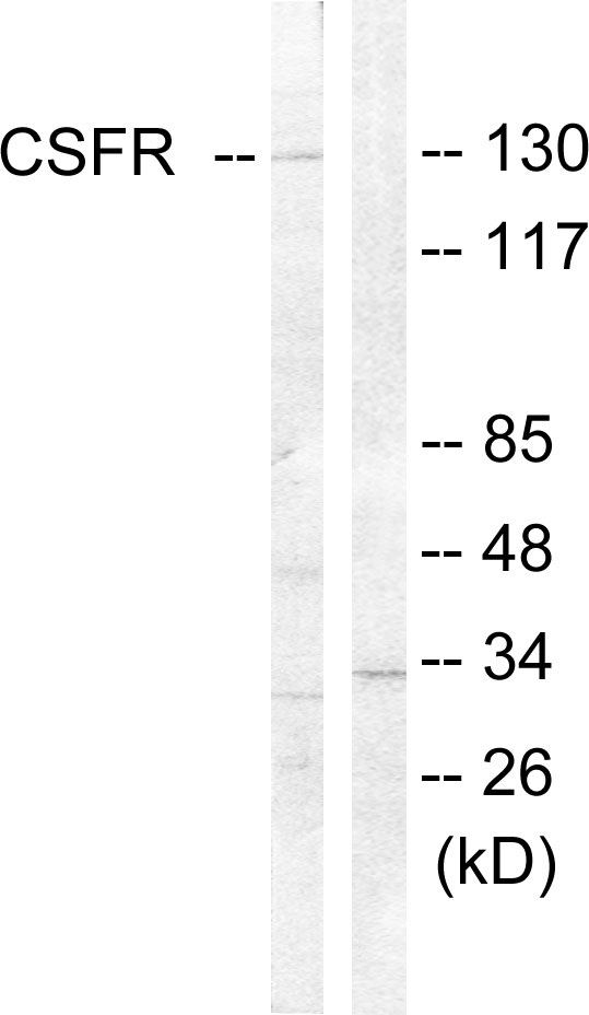 CSF1R / CD115 / FMS Antibody - Western blot analysis of lysates from HT29 cells, using CSFR Antibody. The lane on the right is blocked with the synthesized peptide.