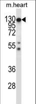 CSF1R / CD115 / FMS Antibody - Mouse Csf1r Antibody western blot of mouse heart tissue lysates (35 ug/lane). The Csf1r antibody detected the Csf1r protein (arrow).