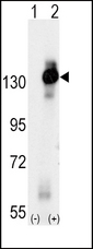 CSF1R / CD115 / FMS Antibody - Western blot of CSF1R (arrow) using rabbit polyclonal CSF1R Antibody. 293 cell lysates (2 ug/lane) either nontransfected (Lane 1) or transiently transfected with the CSF1R gene (Lane 2) (Origene Technologies).