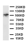 CSF1R / CD115 / FMS Antibody - WB of CSF1R / CD115 / FMS antibody. WB: Rat Intestines Tissue Lysate.