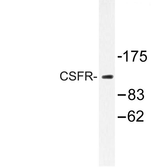 CSF1R / CD115 / FMS Antibody - Western blot of CSFR (N805) pAb in extracts from HT29 cells.