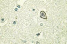 CSF1R / CD115 / FMS Antibody - IHC of M-CSF Receptor (Q718) pAb in paraffin-embedded human brain tissue.