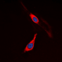 CSF1R / CD115 / FMS Antibody - Immunofluorescent analysis of CD115 staining in COLO205 cells. Formalin-fixed cells were permeabilized with 0.1% Triton X-100 in TBS for 5-10 minutes and blocked with 3% BSA-PBS for 30 minutes at room temperature. Cells were probed with the primary antibody in 3% BSA-PBS and incubated overnight at 4 ??C in a humidified chamber. Cells were washed with PBST and incubated with a DyLight 594-conjugated secondary antibody (red) in PBS at room temperature in the dark. DAPI was used to stain the cell nuclei (blue).