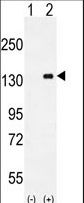 CSF1R / CD115 / FMS Antibody - Western blot of CSF1R (arrow) using mouse Monoclonal CSF1R. 293 cell lysates (2 ug/lane) either nontransfected (Lane 1) or transiently transfected (Lane 2) with the CSF1R gene.