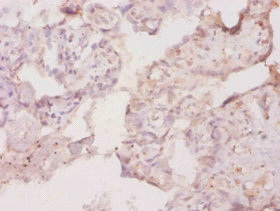 CSF1R / CD115 / FMS Antibody - Immunohistochemistry of paraffin-embedded human placenta tissue using Csf1 Antibody at dilution of 1:20