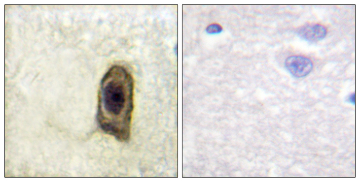 CSF1R / CD115 / FMS Antibody - Immunohistochemistry analysis of paraffin-embedded human brain, using CSFR (Phospho-Tyr561) Antibody. The picture on the right is blocked with the phospho peptide.