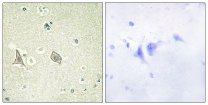 CSF1R / CD115 / FMS Antibody - Immunohistochemistry analysis of paraffin-embedded human brain, using M-CSF Receptor (Phospho-Tyr723) Antibody. The picture on the right is blocked with the phospho peptide.