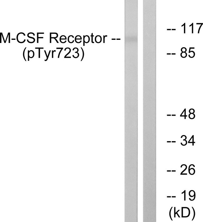 CSF1R / CD115 / FMS Antibody - Western blot analysis of lysates from HUVEC cells treated with PMA 125ng/ml 30', using M-CSF Receptor (Phospho-Tyr723) Antibody. The lane on the right is blocked with the phospho peptide.