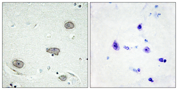 CSF1R / CD115 / FMS Antibody - Immunohistochemistry analysis of paraffin-embedded human brain, using CSFR (Phospho-Tyr809) Antibody. The picture on the right is blocked with the phospho peptide.