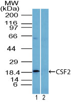 CSF2 / GM-CSF Antibody - Western blot of CSF2 in U937 cell lysate in the 1) absence and 2) presence of immunizing peptide using Polyclonal Antibody to GMCSF2/CSF2 at 3 ug/ml. Goat anti-rabbit Ig HRP secondary antibody, and PicoTect ECL substrate solution were used for this test.