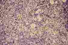 CSF2 / GM-CSF Antibody - Anti-GM-CSF Picoband antibody,-1. JPGIHC(P): Mouse Spleen Tissue
