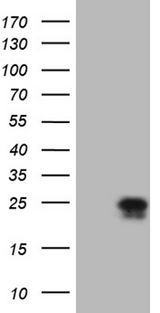 CSF2 / GM-CSF Antibody - HEK293T cells were transfected with the pCMV6-ENTRY control. (Left lane) or pCMV6-ENTRY CSF2. (Right lane) cDNA for 48 hrs and lysed
