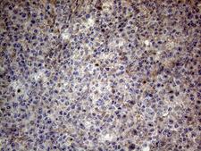 CSF2 / GM-CSF Antibody - Immunohistochemical staining of paraffin-embedded Human lymph node tissue within the normal limits using anti-CSF2 mouse monoclonal antibody. (Heat-induced epitope retrieval by 1mM EDTA in 10mM Tris buffer. (pH8.5) at 120°C for 3 min. (1:150)
