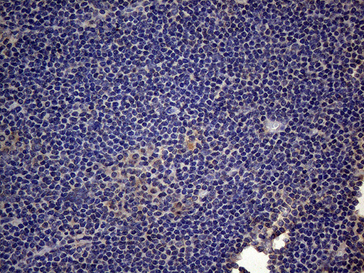 CSF2 / GM-CSF Antibody - Immunohistochemical staining of paraffin-embedded Human tonsil within the normal limits using anti-CSF2 mouse monoclonal antibody. (Heat-induced epitope retrieval by 1mM EDTA in 10mM Tris buffer. (pH8.5) at 120°C for 3 min. (1:150)