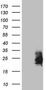 CSF2 / GM-CSF Antibody - HEK293T cells were transfected with the pCMV6-ENTRY control. (Left lane) or pCMV6-ENTRY CSF2. (Right lane) cDNA for 48 hrs and lysed. Equivalent amounts of cell lysates. (5 ug per lane) were separated by SDS-PAGE and immunoblotted with anti-CSF2. (1:2000)
