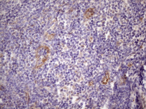 CSF2 / GM-CSF Antibody - Immunohistochemical staining of paraffin-embedded Human tonsil within the normal limits using anti-CSF2 mouse monoclonal antibody. (Heat-induced epitope retrieval by 1 mM EDTA in 10mM Tris, pH8.5, 120C for 3min. (1:150)
