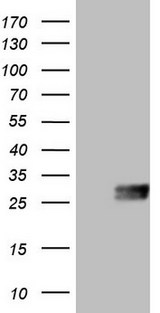 CSF2 / GM-CSF Antibody - HEK293T cells were transfected with the pCMV6-ENTRY control (Left lane) or pCMV6-ENTRY CSF2 (Right lane) cDNA for 48 hrs and lysed. Equivalent amounts of cell lysates (5 ug per lane) were separated by SDS-PAGE and immunoblotted with anti-CSF2 (1:2000).