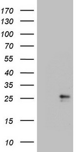 CSF2 / GM-CSF Antibody - HEK293T cells were transfected with the pCMV6-ENTRY control. (Left lane) or pCMV6-ENTRY CSF2. (Right lane) cDNA for 48 hrs and lysed. Equivalent amounts of cell lysates. (5 ug per lane) were separated by SDS-PAGE and immunoblotted with anti-CSF2. (1:500)