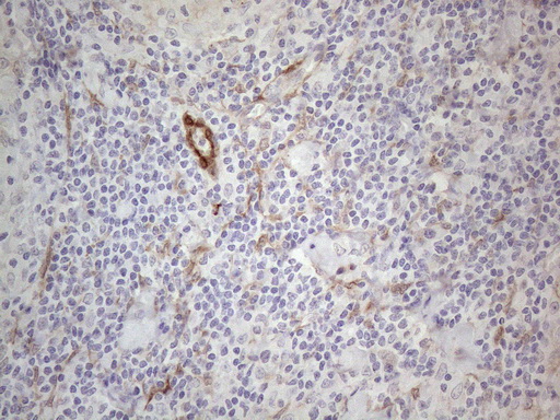 CSF2 / GM-CSF Antibody - Immunohistochemical staining of paraffin-embedded Human lymph node tissue within the normal limits using anti-CSF2 mouse monoclonal antibody. (Heat-induced epitope retrieval by 1mM EDTA in 10mM Tris buffer. (pH8.5) at 120°C for 3 min. (1:150)