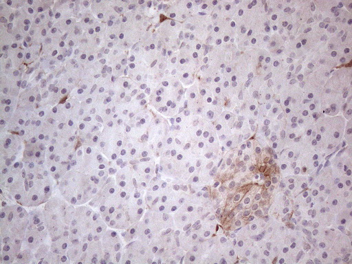 CSF2 / GM-CSF Antibody - Immunohistochemical staining of paraffin-embedded Human pancreas tissue within the normal limits using anti-CSF2 mouse monoclonal antibody. (Heat-induced epitope retrieval by 1mM EDTA in 10mM Tris buffer. (pH8.5) at 120°C for 3 min. (1:150)