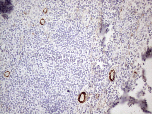 CSF2 / GM-CSF Antibody - Immunohistochemical staining of paraffin-embedded Human tonsil within the normal limits using anti-CSF2 mouse monoclonal antibody. (Heat-induced epitope retrieval by 1mM EDTA in 10mM Tris buffer. (pH8.5) at 120°C for 3 min. (1:150)