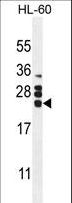 CSF2 / GM-CSF Antibody - CSF2 Antibody western blot of HL60 cell line lysates (35 ug/lane). The CSF2 antibody detected the CSF2 protein (arrow).
