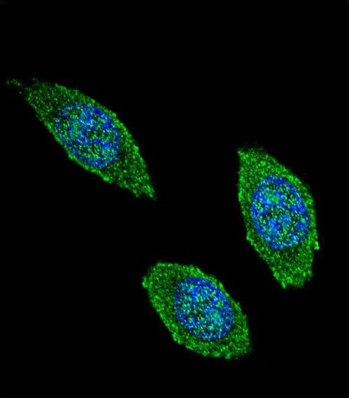 CSF2 / GM-CSF Antibody - Confocal immunofluorescence of CSF2 Antibody with 293 cell followed by Alexa Fluor 488-conjugated goat anti-rabbit lgG (green). DAPI was used to stain the cell nuclear (blue).