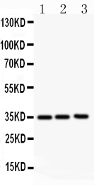 CSF2 / GM-CSF Antibody - Western blot - Anti-GM-CSF Antibody
