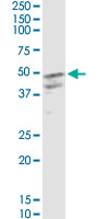 CSF2 / GM-CSF Antibody - CSF2 monoclonal antibody (M01), clone 2G9. Western Blot analysis of CSF2 expression in HeLa.