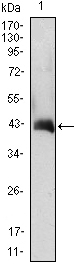 CSF2 / GM-CSF Antibody - Western blot using CSF2 monoclonal antibody against CSF2(AA: 18-144)-hIgGFc transfected HEK293 cell lysate.