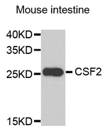 CSF2 / GM-CSF Antibody - Western blot analysis of extracts of mouse intestine.