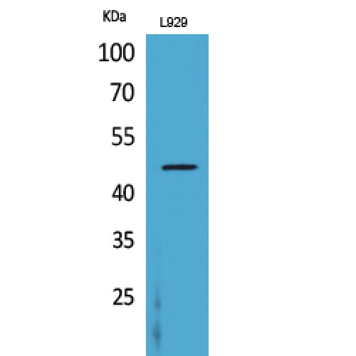 CSF2RA / CD116 Antibody - Western blot of CD116 antibody