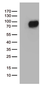CSF2RA / CD116 Antibody - HEK293T cells were transfected with the pCMV6-ENTRY control. (Left lane) or pCMV6-ENTRY CSF2RA. (Right lane) cDNA for 48 hrs and lysed. Equivalent amounts of cell lysates. (5 ug per lane) were separated by SDS-PAGE and immunoblotted with anti-CSF2RA. (1:500)