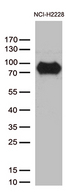 CSF2RA / CD116 Antibody - Western blot analysis of extracts. (35ug) from NCI-H2228 by using anti-CSF2RA monoclonal antibody. (1:250)