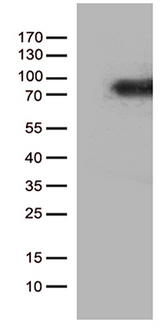 CSF2RA / CD116 Antibody - HEK293T cells were transfected with the pCMV6-ENTRY control. (Left lane) or pCMV6-ENTRY CSF2RA. (Right lane) cDNA for 48 hrs and lysed