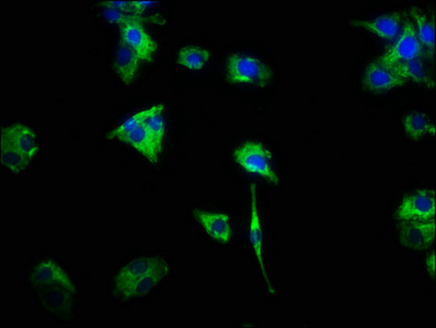 CSF2RA / CD116 Antibody - Immunofluorescence staining of HepG2 cells with CSF2RA Antibody at 1:466, counter-stained with DAPI. The cells were fixed in 4% formaldehyde, permeabilized using 0.2% Triton X-100 and blocked in 10% normal Goat Serum. The cells were then incubated with the antibody overnight at 4°C. The secondary antibody was Alexa Fluor 488-congugated AffiniPure Goat Anti-Rabbit IgG(H+L).