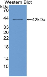 CSF2RA / CD116 Antibody - Western blot of recombinant CSF2RA / CD116.