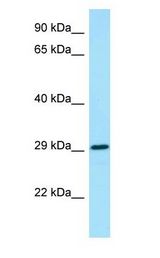 CSF2RA / CD116 Antibody - CSF2RA / CD116 antibody Western Blot of Fetal Heart.  This image was taken for the unconjugated form of this product. Other forms have not been tested.