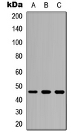 CSF2RA / CD116 Antibody - Western blot analysis of CD116 expression in HEK293T (A); Raw264.7 (B); H9C2 (C) whole cell lysates.