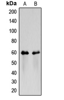 CSF2RA / CD116 Antibody - Western blot analysis of CD116 expression in HeLa (A); NIH3T3 (B) whole cell lysates.
