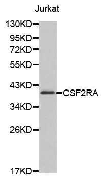 CSF2RA / CD116 Antibody - Western blot analysis of extracts of Jurkat cell line, using CSF2RA antibody.