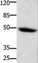 CSF2RA / CD116 Antibody - Western blot analysis of Mouse heart tissue, using CSF2RA Polyclonal Antibody at dilution of 1:400.