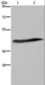 CSF2RA / CD116 Antibody - Western blot analysis of Human placenta tissue and HepG2 cell, using CSF2RA Polyclonal Antibody at dilution of 1:250.