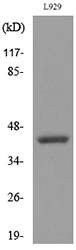 CSF2RA / CD116 Antibody - Western blot analysis of lysate from L929 cells, using CSF2RA Antibody.