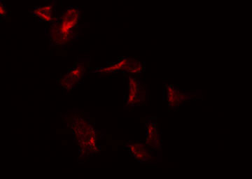 CSF2RA / CD116 Antibody - Staining COLO205 cells by IF/ICC. The samples were fixed with PFA and permeabilized in 0.1% Triton X-100, then blocked in 10% serum for 45 min at 25°C. The primary antibody was diluted at 1:200 and incubated with the sample for 1 hour at 37°C. An Alexa Fluor 594 conjugated goat anti-rabbit IgG (H+L) Ab, diluted at 1/600, was used as the secondary antibody.