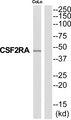 CSF2RA / CD116 Antibody - Western blot analysis of extracts from COLO205 cells, using CSF2RA antibody.