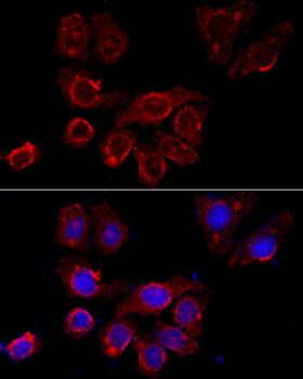 CSF2RA / CD116 Antibody - Immunofluorescence analysis of HeLa cells using CSF2RA Polyclonal Antibody at dilution of 1:100 (40x lens).Blue: DAPI for nuclear staining.