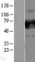 CSF2RA / CD116 Protein - Western validation with an anti-DDK antibody * L: Control HEK293 lysate R: Over-expression lysate