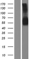 CSF2RA / CD116 Protein - Western validation with an anti-DDK antibody * L: Control HEK293 lysate R: Over-expression lysate