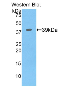 CSF2RB / CD131 Antibody - Western blot of recombinant CSF2RB / CD131.  This image was taken for the unconjugated form of this product. Other forms have not been tested.